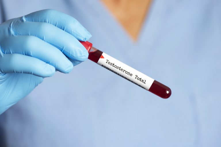 Blood Testing for Sexual Health Essential Insights Boston Medical Group