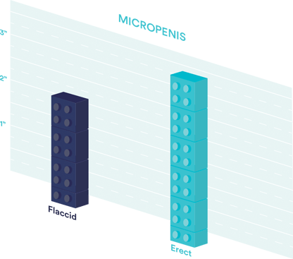 micropenis-infographic